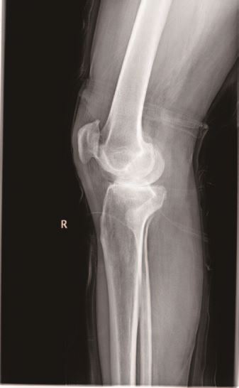 县医院报纸77期_页面_2_图像_0008.jpg 县医院报纸77期_页面_2_图像_0008.jpg