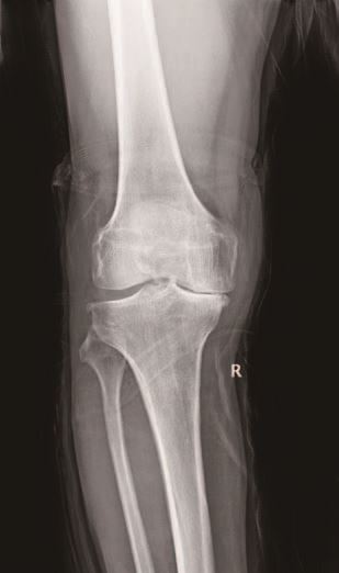 县医院报纸77期_页面_2_图像_0003.jpg 县医院报纸77期_页面_2_图像_0003.jpg