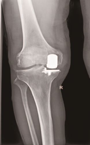 县医院报纸77期_页面_2_图像_0005.jpg 县医院报纸77期_页面_2_图像_0005.jpg