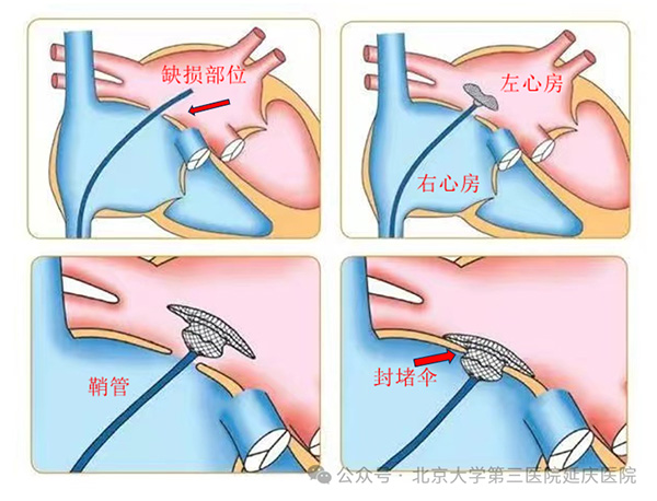 图片11.jpg