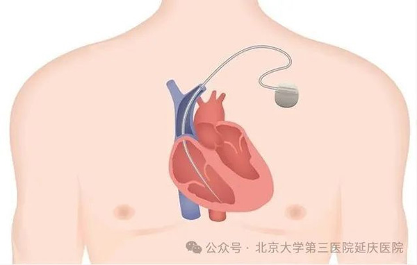图片13.jpg
