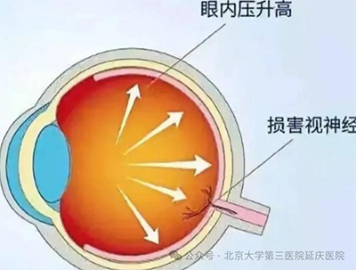 图片16.jpg 图片16.jpg