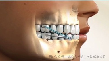 图片30.jpg 图片30.jpg