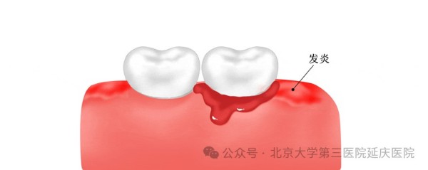 图片21.jpg 图片21.jpg